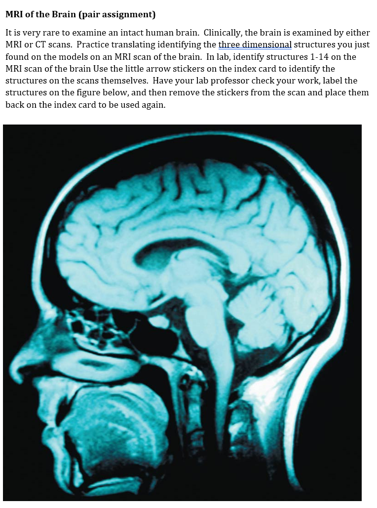 Solved MRI of the Brain (pair assignment) It is very rare to | Chegg.com