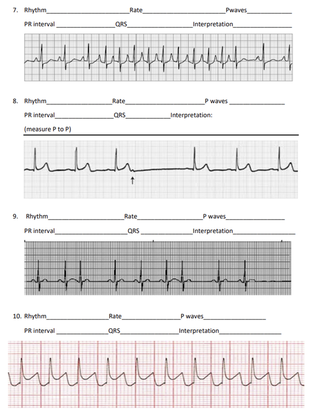 Solved Rate Pwaves 7. Rhythm_ PR interval QRS | Chegg.com