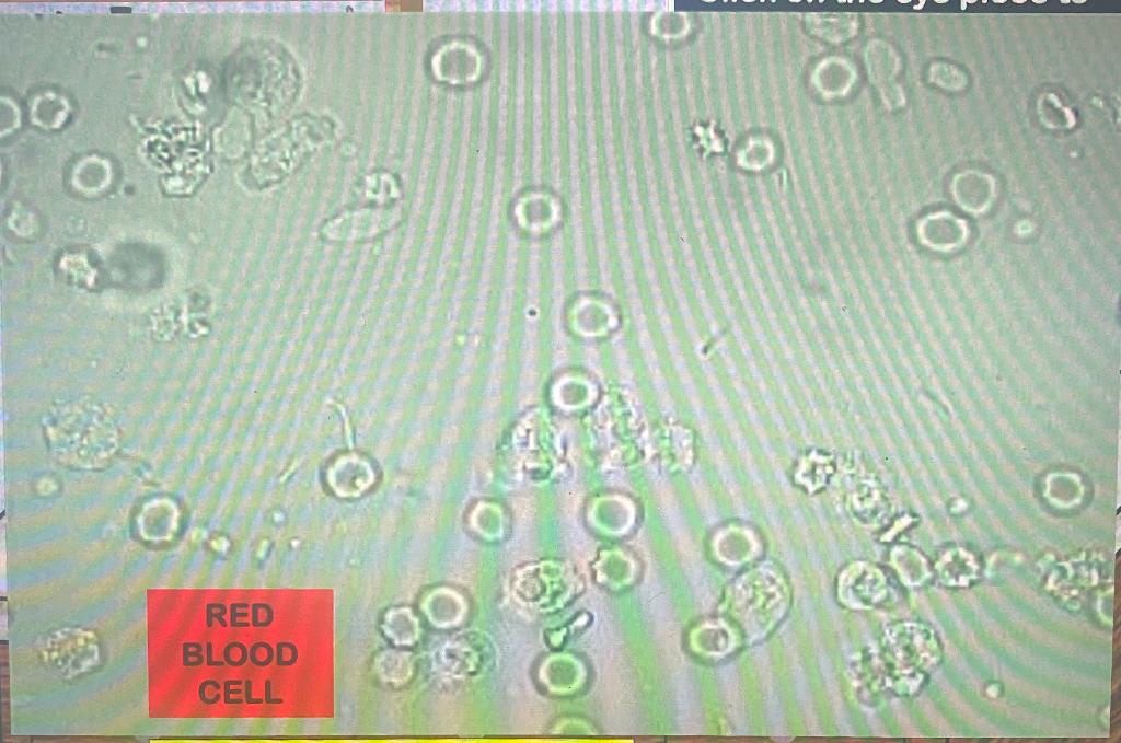 of-red-blood-cells-normal-or-abnormal-range-chegg