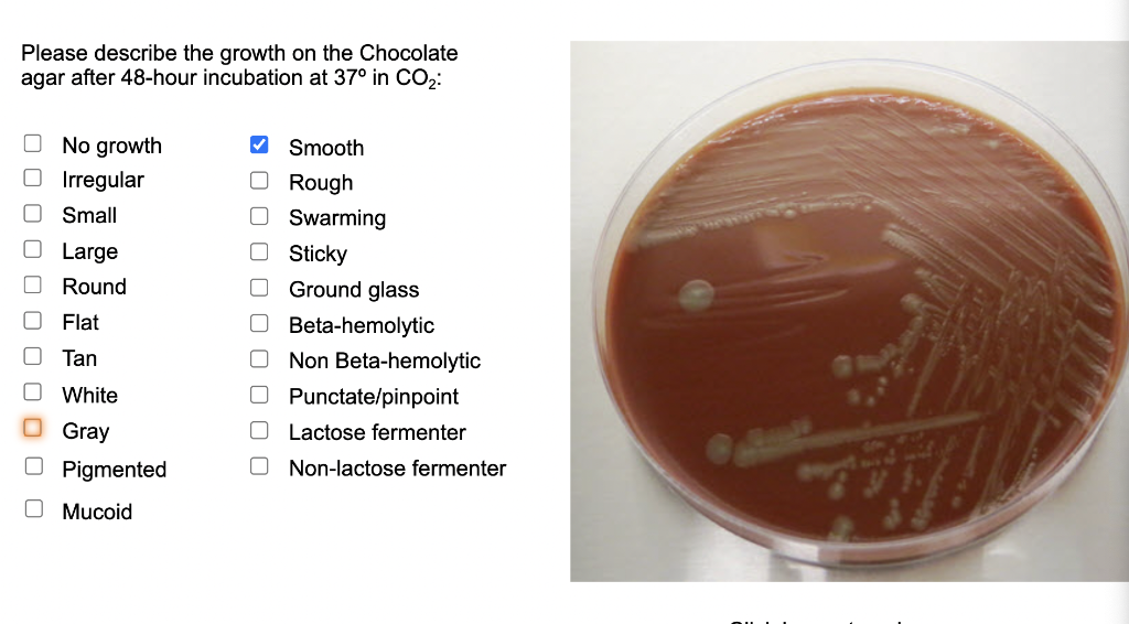 Solved Please describe the growth on the Chocolate agar