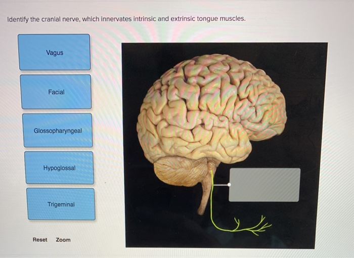 Solved dentify the cranial nerve, which innervates intrinsic | Chegg.com