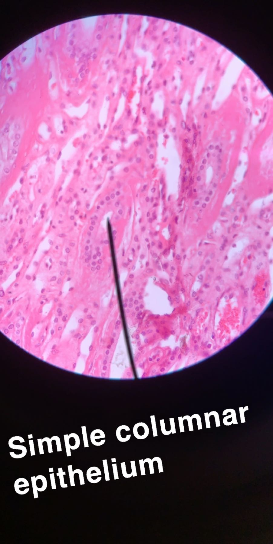 Simple Columnar With Label Solved Tissue name: Simple Columnar Epithelium Label the | Chegg.com