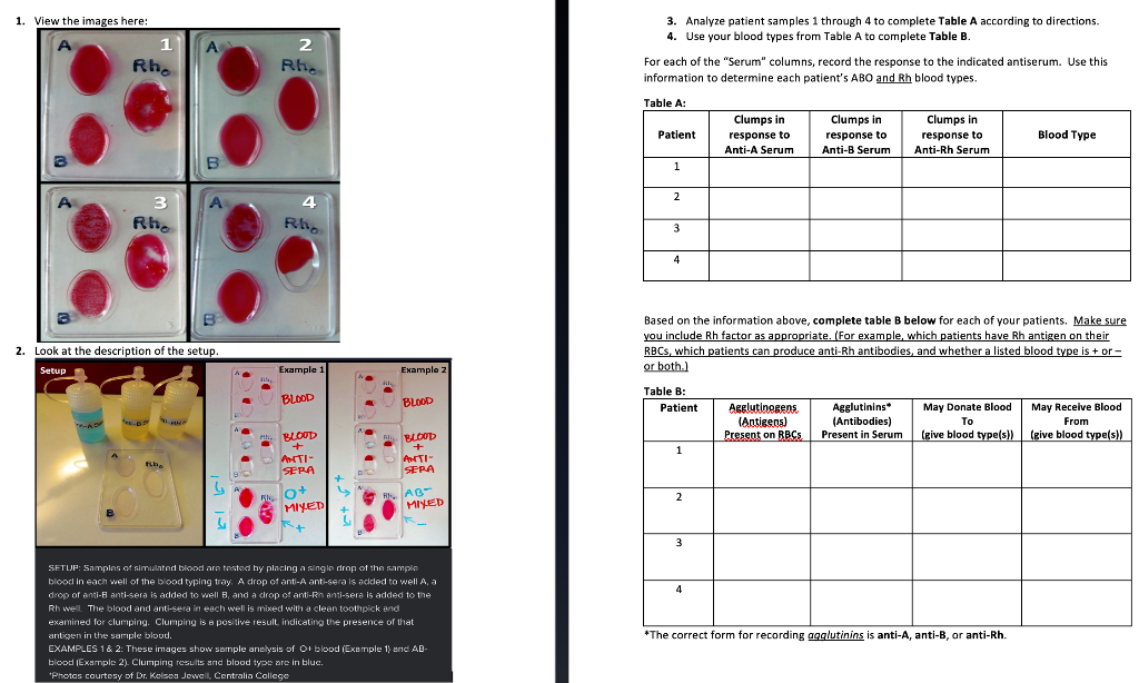 Solved 1) Look This Blood Testing Experiment And Fill The | Chegg.com