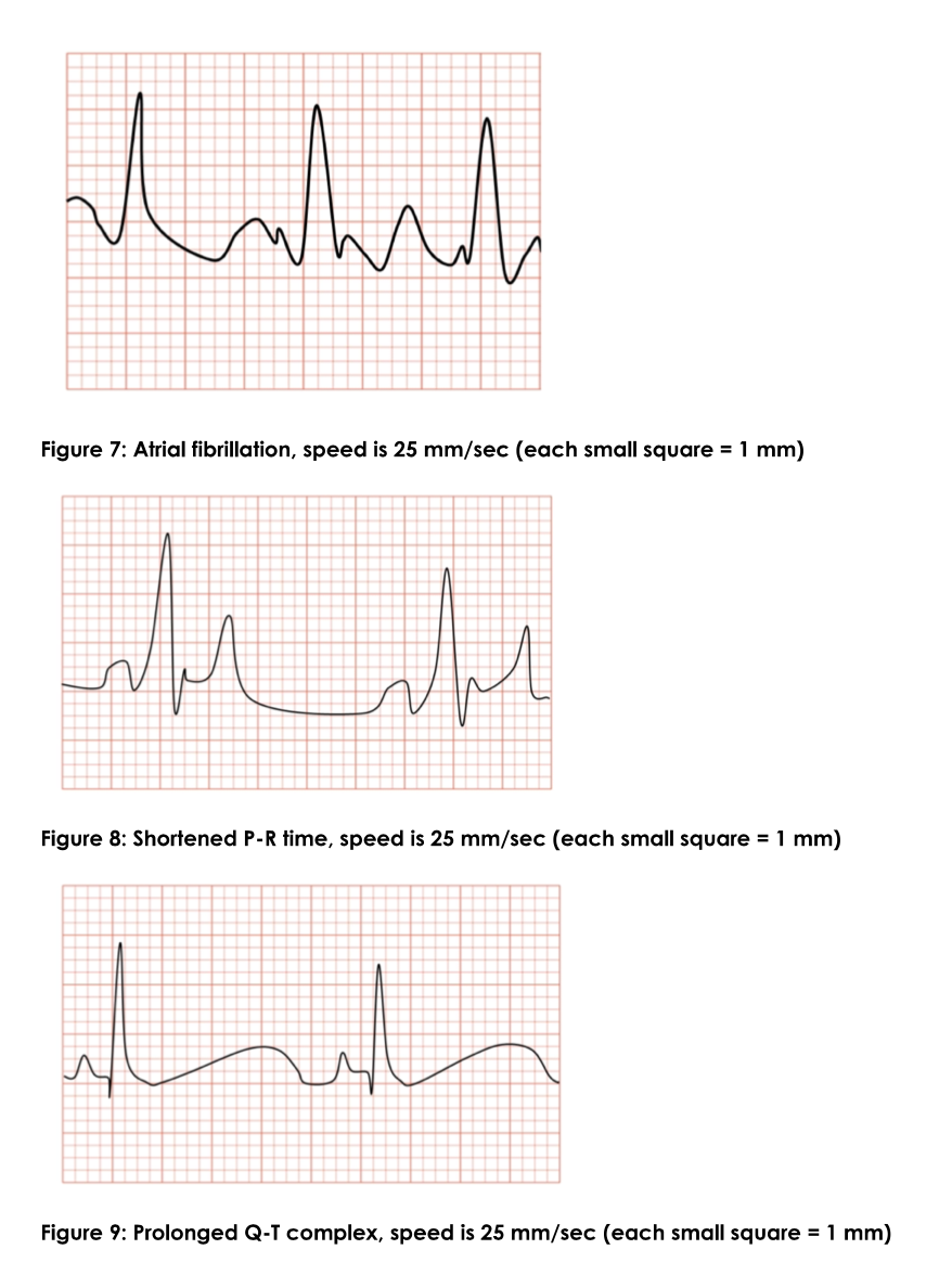 Activity 4 Reading an EKG 1. Label the parts of the | Chegg.com