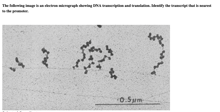 Solved The following image is an electron micrograph showing | Chegg.com
