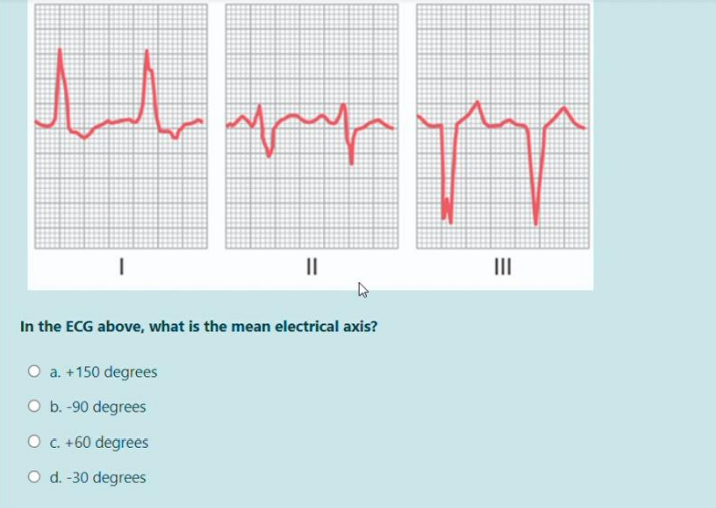 Solved اما البال | II In the ECG above, what is the mean | Chegg.com