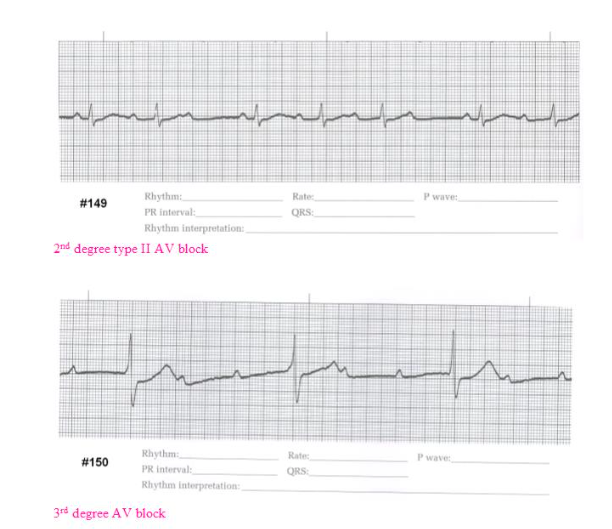 Solved How do you determine the rate and PR interval for an | Chegg.com