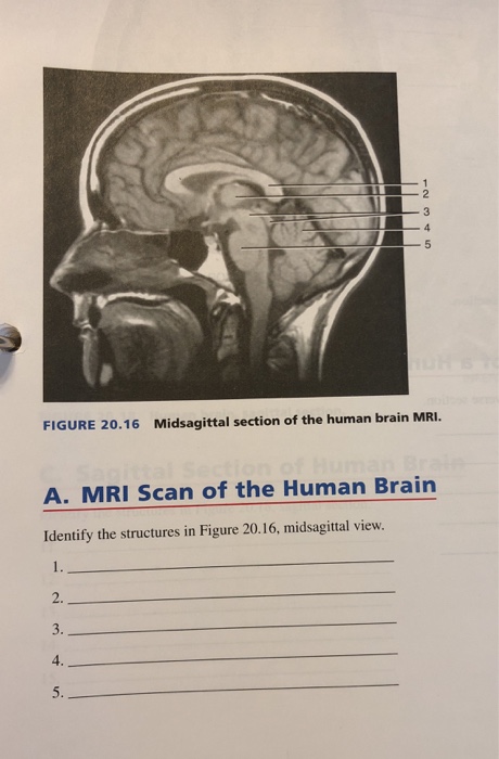 Solved FIGURE 20.16 Midsagittal section of the human brain | Chegg.com