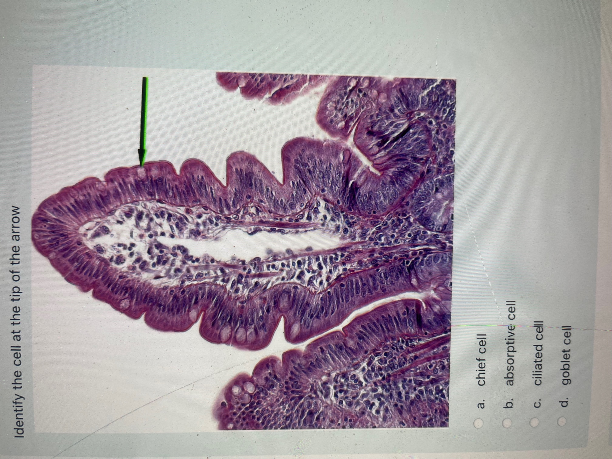 Solved Identify the cell at the tip of the arrow a. chief | Chegg.com