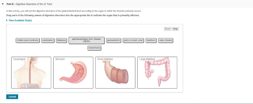 Solved Part D Digestive Disorders Of The GI Tract In This | Chegg.com