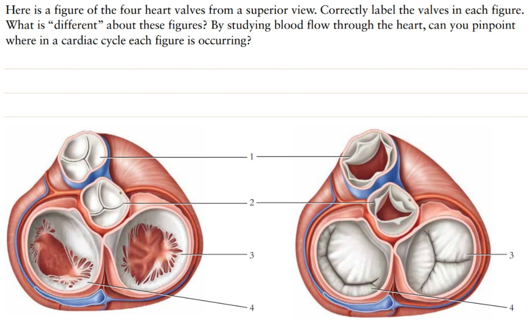 Solved Here is a figure of the four heart valves from a | Chegg.com