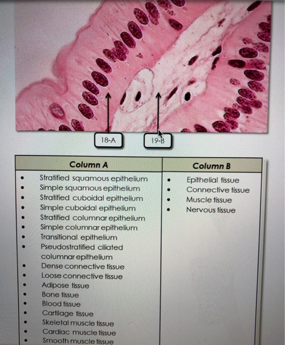 Solved Identity The Tissues Shown. 18-a Should Come From The 