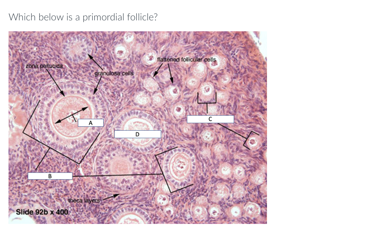 Solved Which below is a primordial follicle? | Chegg.com