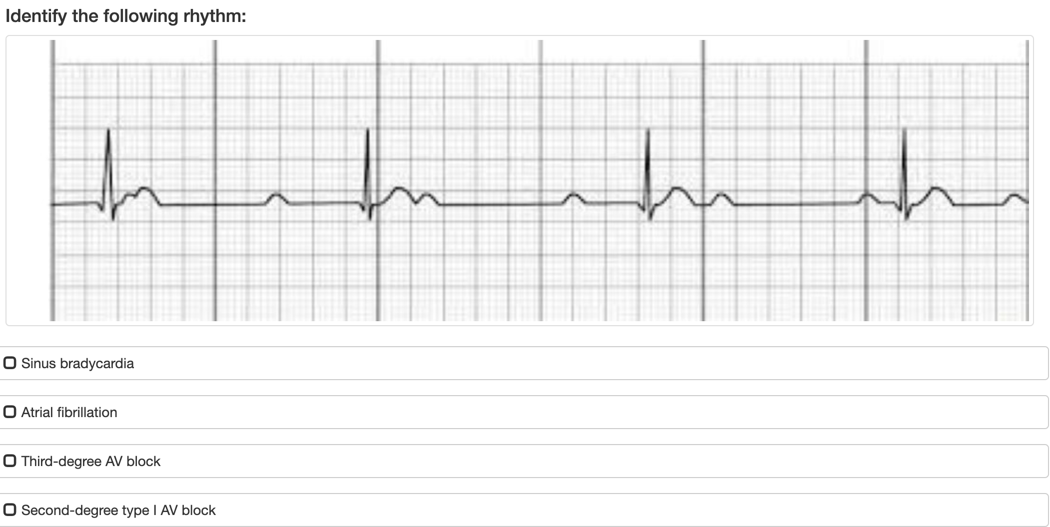 Solved Identify the following rhythm:Sinus bradycardiaAtrial | Chegg.com