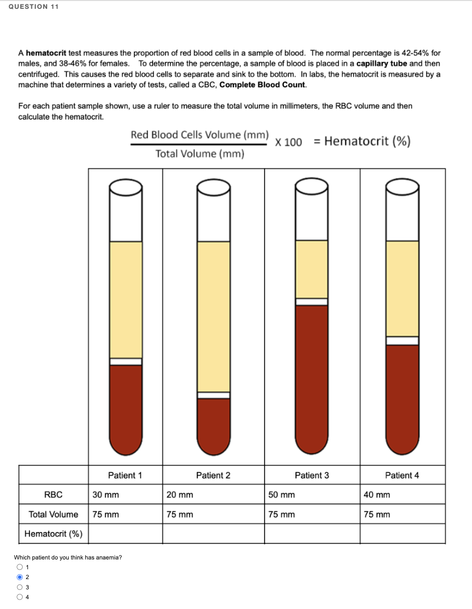 Hematocrit: What Is It, Importance, And More Osmosis, 57% OFF