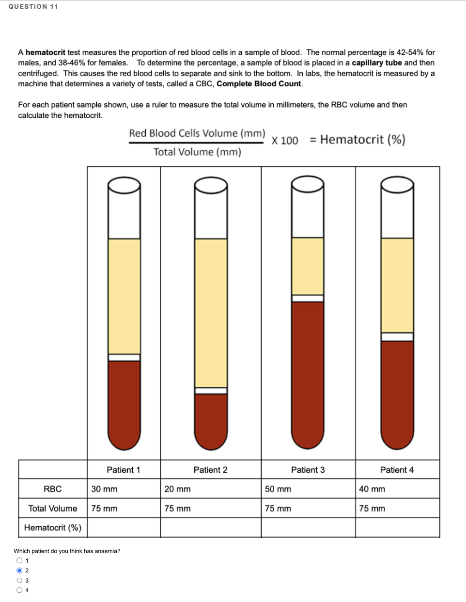 Hematocrit What Is It Importance And More Osmosis 43 OFF