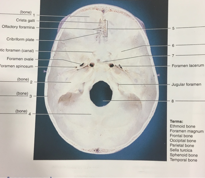 solved-bone-crista-galli-olfactory-foramina-cribriform-chegg