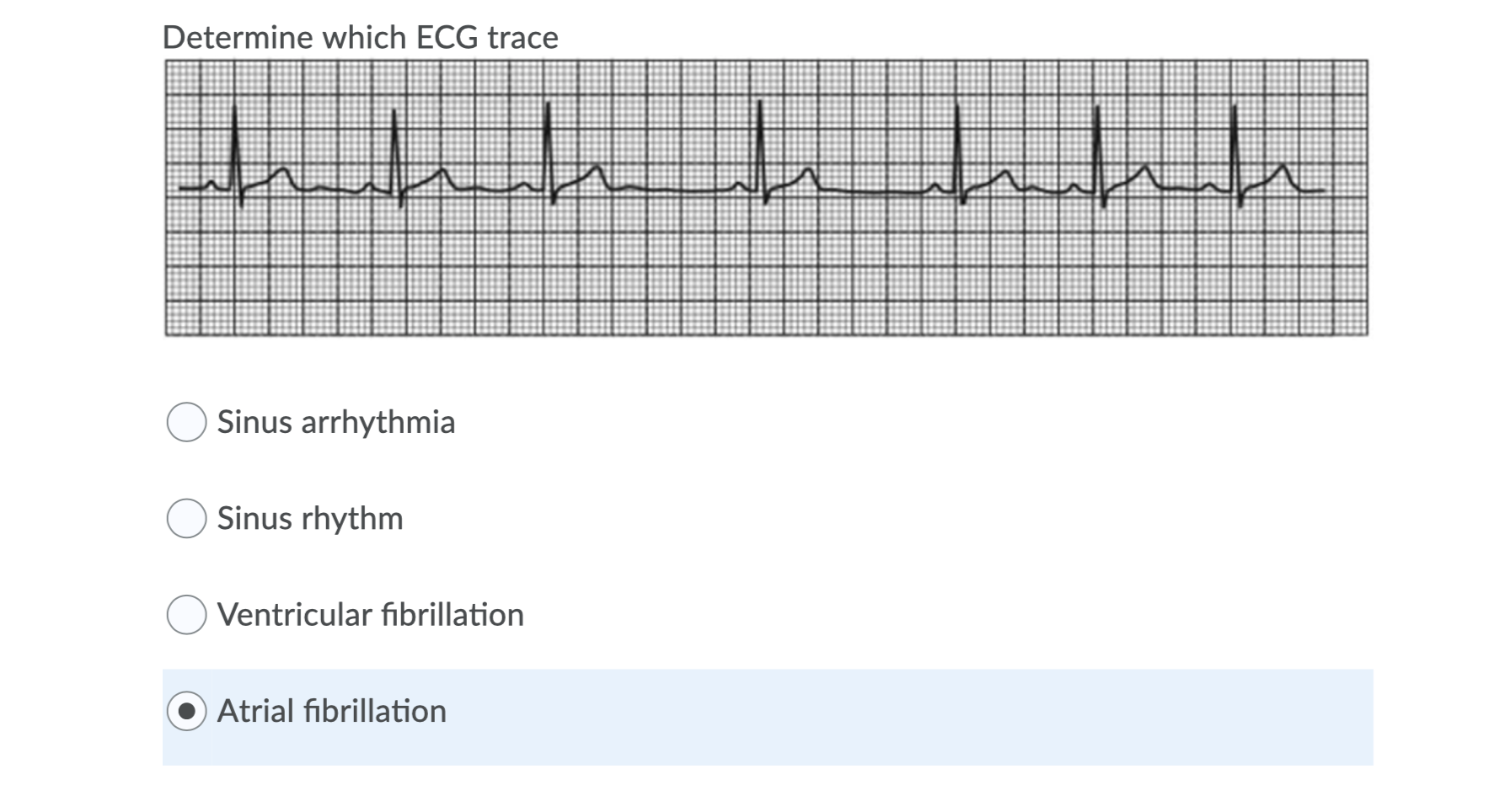 Determine Which Ecg Trace Ecg2 Www Atrial Chegg Com