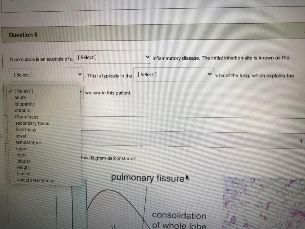 Solved Question 6 Tuberculosis is an example of a [Select] | Chegg.com