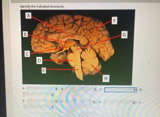 Solved Identify the indicated structures. А) F B B G C D E E | Chegg.com