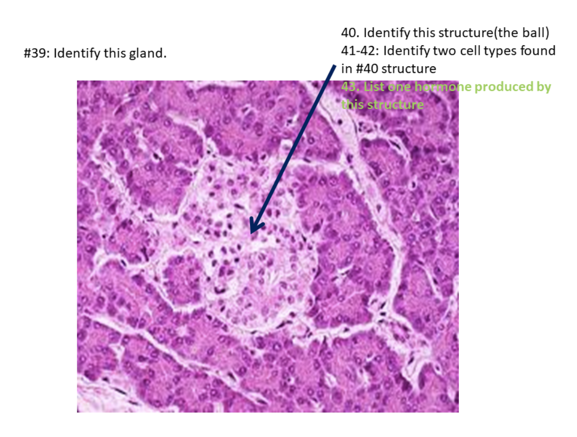 Solved #39: Identify this gland. 40. Identify this | Chegg.com