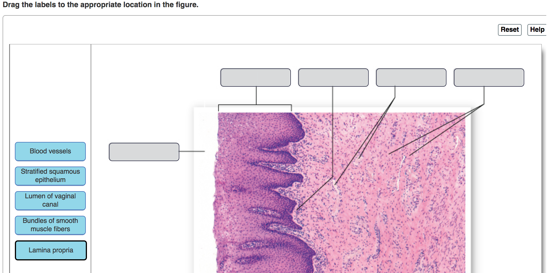 Drag the labels onto the diagram to identify structures associated with the  transitional epithelium of the urinary bladder (exam 2) Diagram