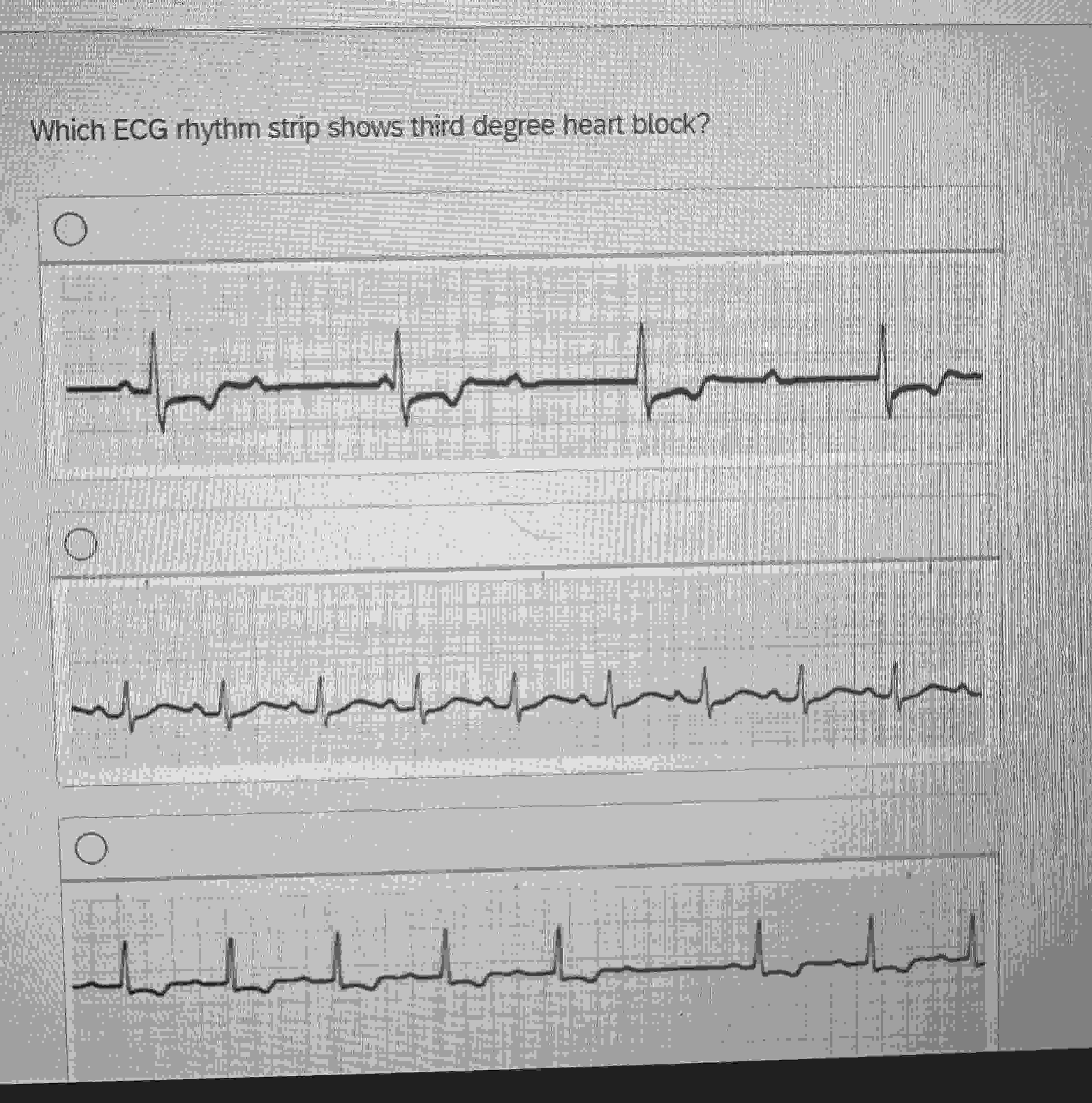 solved-which-ecg-rhythm-strip-shows-third-degree-heart-chegg