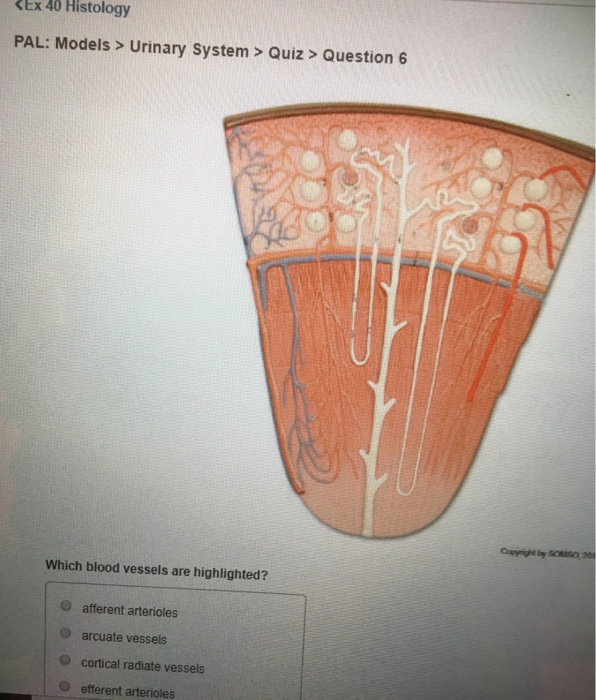Solved PAL Models > Urinary System > Quiz> Question4 Whi...