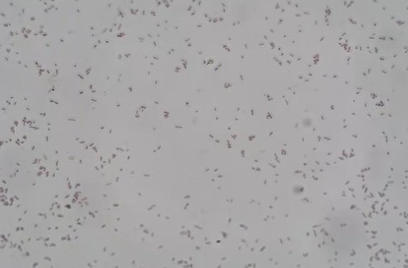 Solved Unknown Project Microbiology There Are Two An 