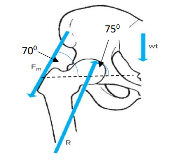 Solved How much compression acts on the hip during | Chegg.com