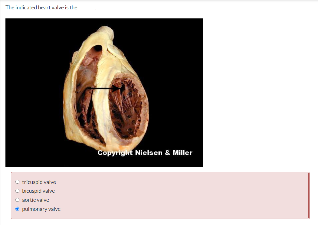 The indicated heart valve is the
tricuspid valve
bicuspid valve