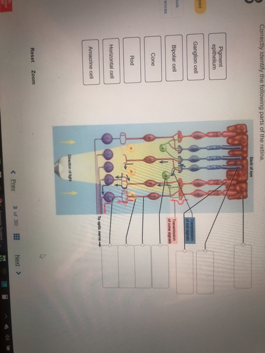 Solved Correctly identify the following parts of the retina.