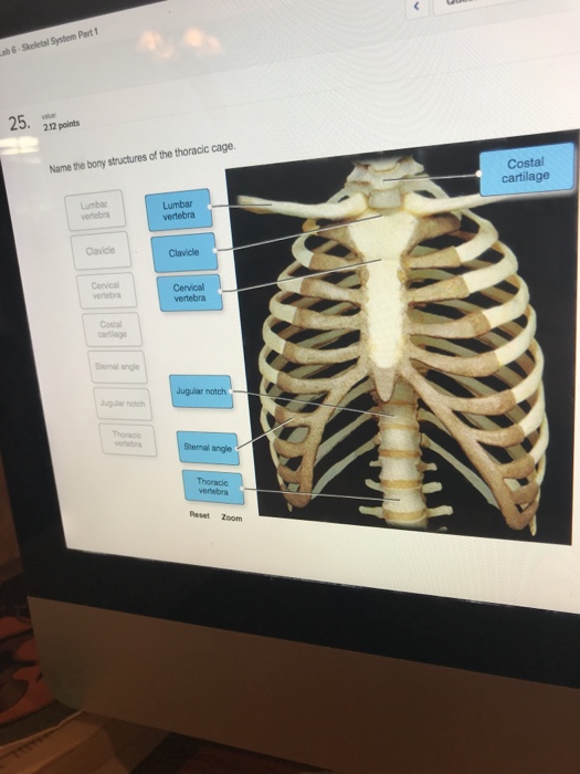 Solved Ab 6-skeletal System Part 25. 212 Points Name The 