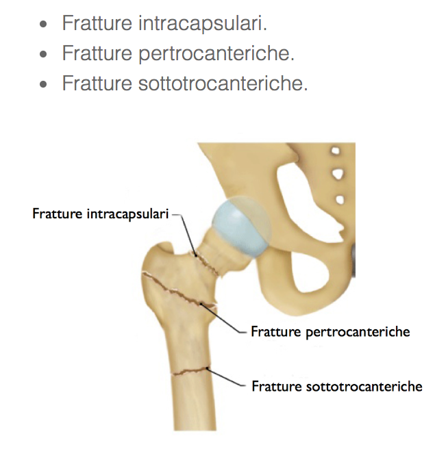 Orto Fratture E Lesioni Parti Molli Aims Flashcards Chegg Com