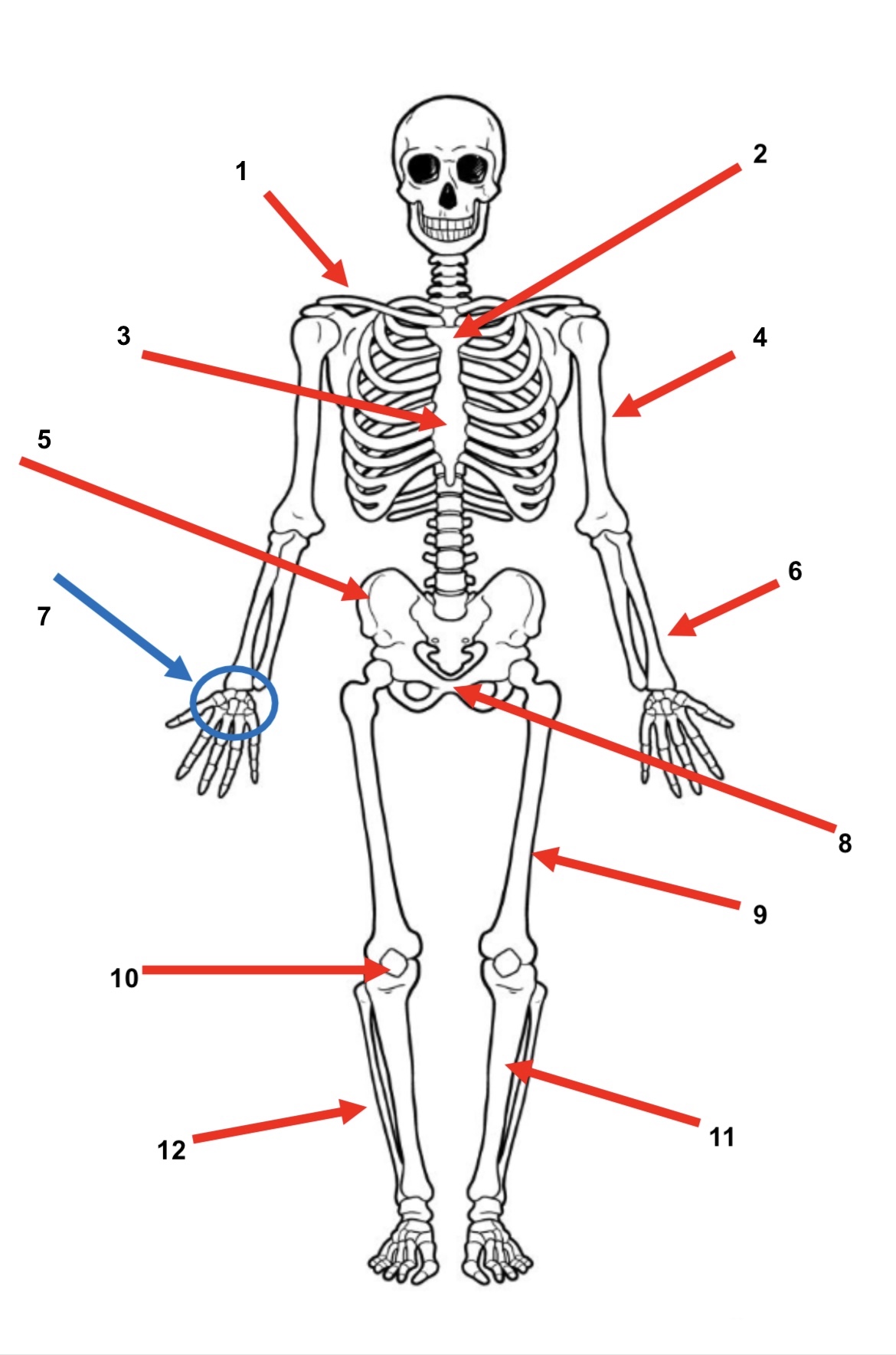 Solved -*1.RED ARROW- name the bone-*2.BLUE ARROW-name the | Chegg.com