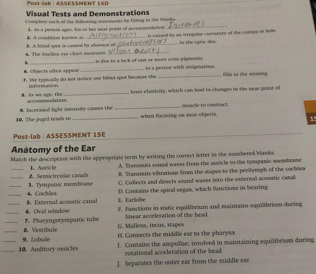 Solved 15 Postlab ASSESSMENT 151 Anatomy of the Eye Match