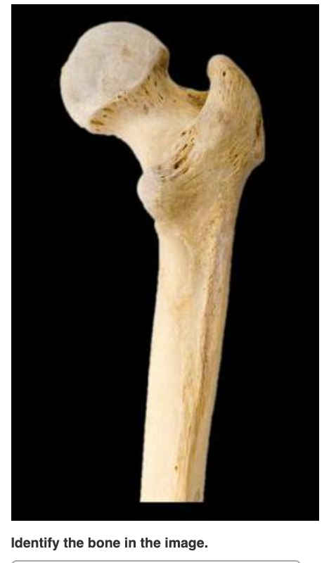 Solved Identify the bone in the image. | Chegg.com