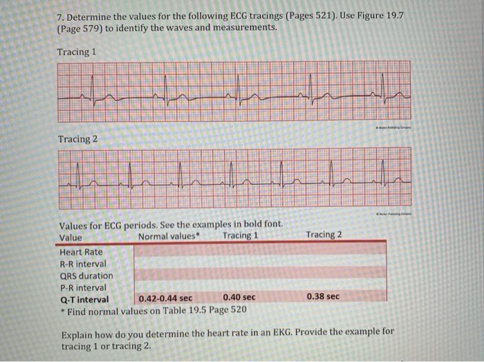 Solved 7. Determine the values for the following ECG | Chegg.com