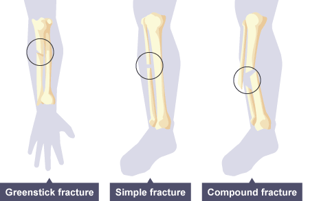 Injuries And Treatment Flashcards Chegg Com