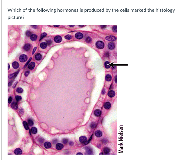 Solved Which of the following hormones is produced by the | Chegg.com