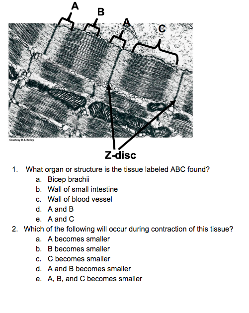 Z Disk Definition Solved Z-disc 1. What organ or structure is the tissue | Chegg.com