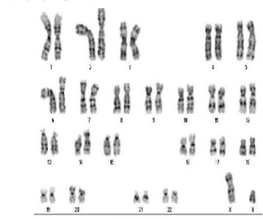 Solved What is wrong with this Karyotype? | Chegg.com