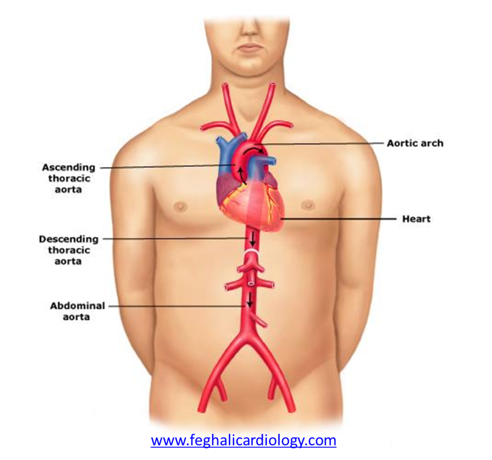 solved-the-aorta-is-a-large-artery-that-ascends-from-the-chegg