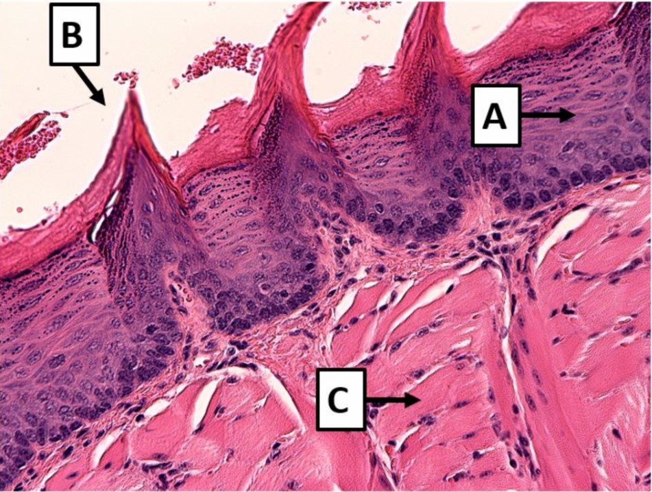 Solved Please identify A and B. C is the sub-basal layer. | Chegg.com