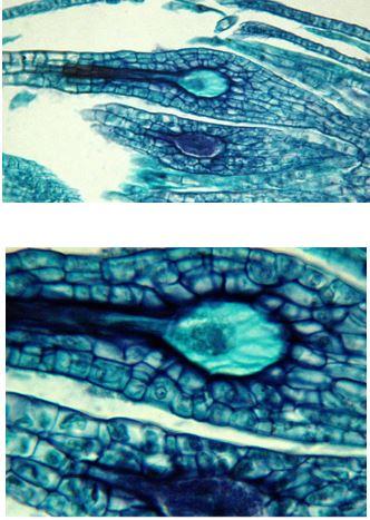 Solved Label the archegonium in the slides below. | Chegg.com