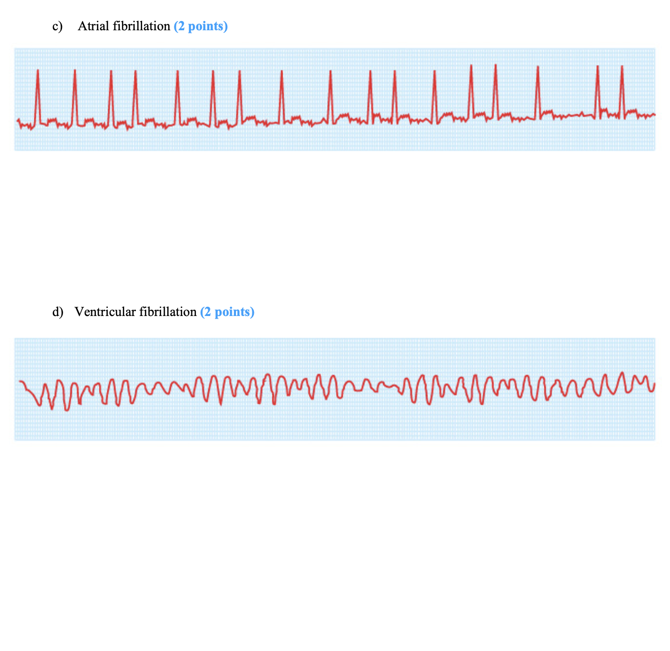 Solved Question 1 (L5) (8 Points) The Electrocardiogram | Chegg.com