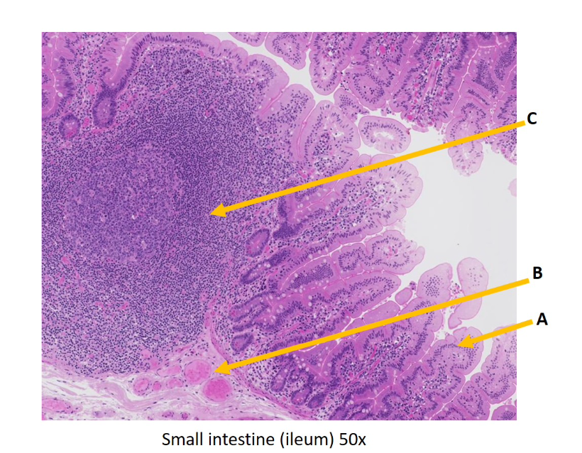 Small intestine (ileum) \( 50 x \)