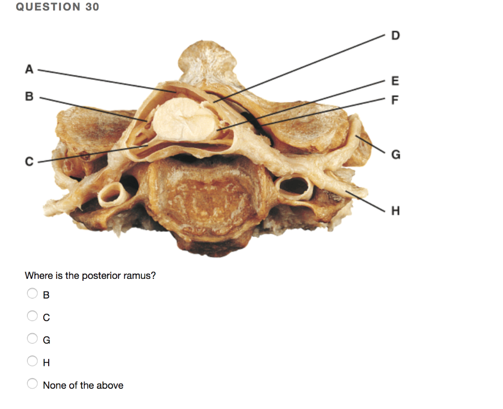 solved-question-30-where-is-the-posterior-ramus-none-of-the-chegg