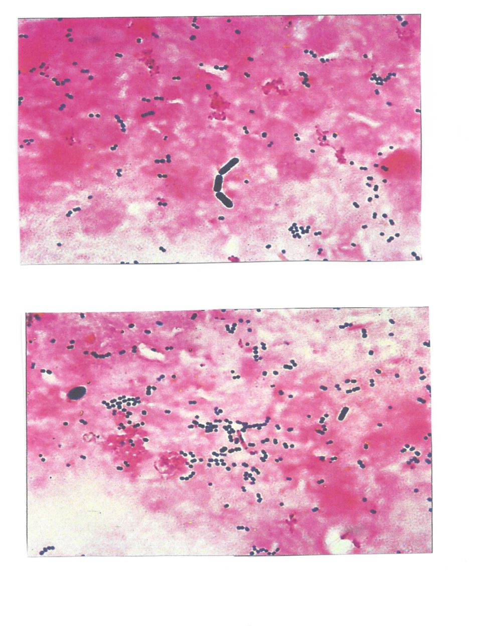 solved-identify-if-the-photos-below-are-a-gram-positive-or-chegg