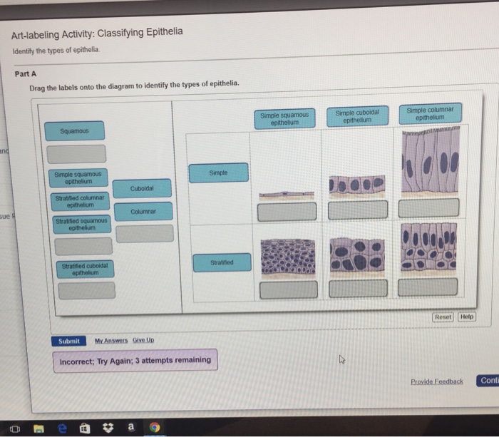 Solved Art-labeling Activity: Classifying Epithelia | Chegg.com